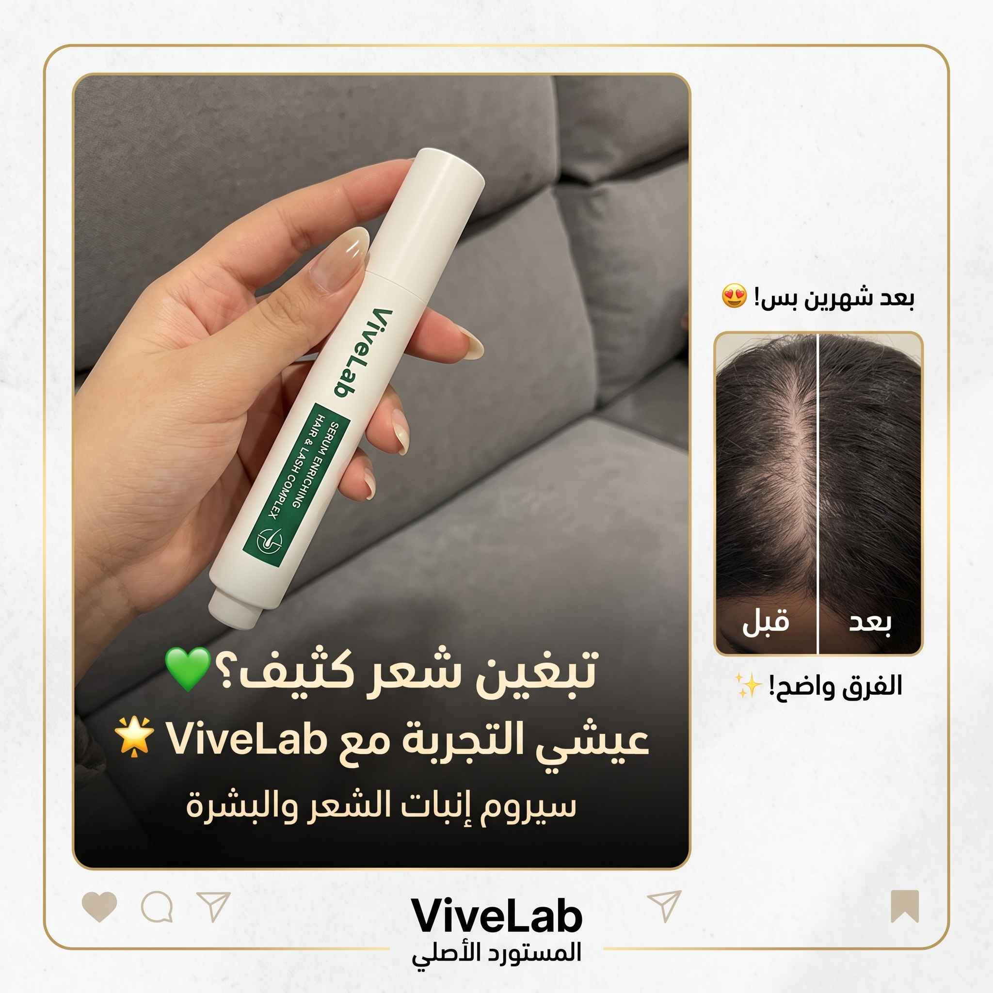 سيروم بديل زراعة الشعر